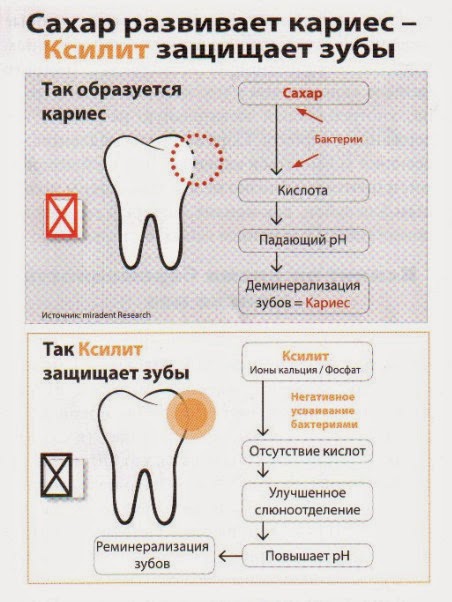 Протокол лечения кариеса. Местный иммунитет при кариесе. Ксилит и кариес. Ксилит защищает зубы. Ксилит и зубы.