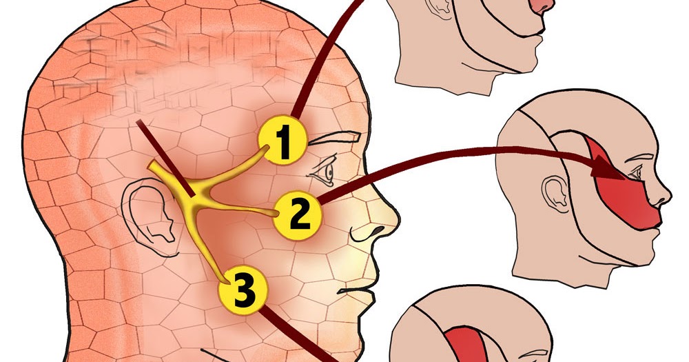Воспаление тройничного нерва фото симптомы