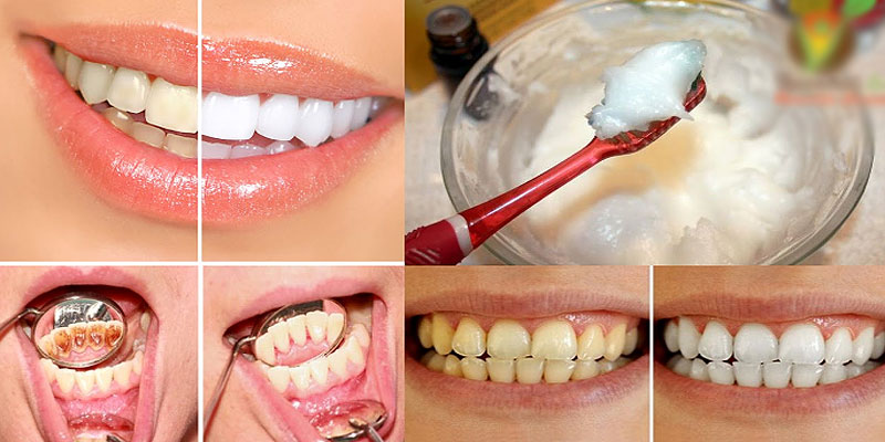 Как восстановить зубы и волосы