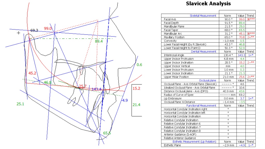 Славичек. Анализ ТРГ В боковой проекции. Точки ТРГ В ортодонтии. ТРГ В боковой проекции норма. Анализ ТРГ по Славичеку.