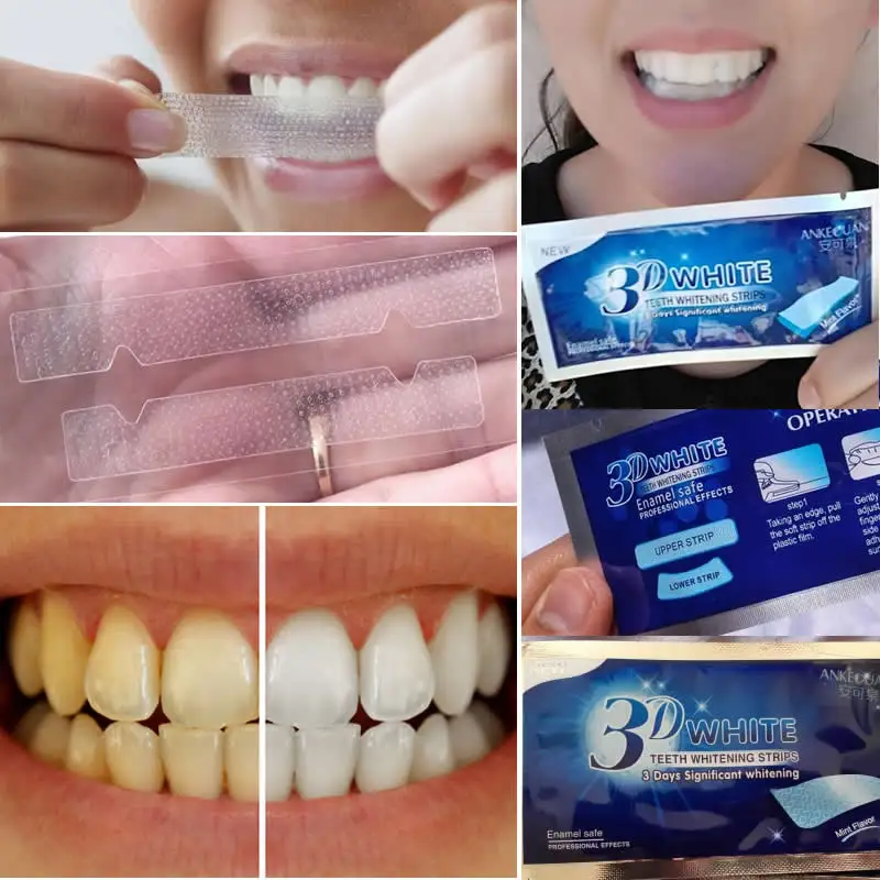 Для отбеливания зубов используют. Отбеливающие полоски 9d. Отбеливающие полоски для зубов. Зубные полоски отбеливающие. Пластины для отбеливания.