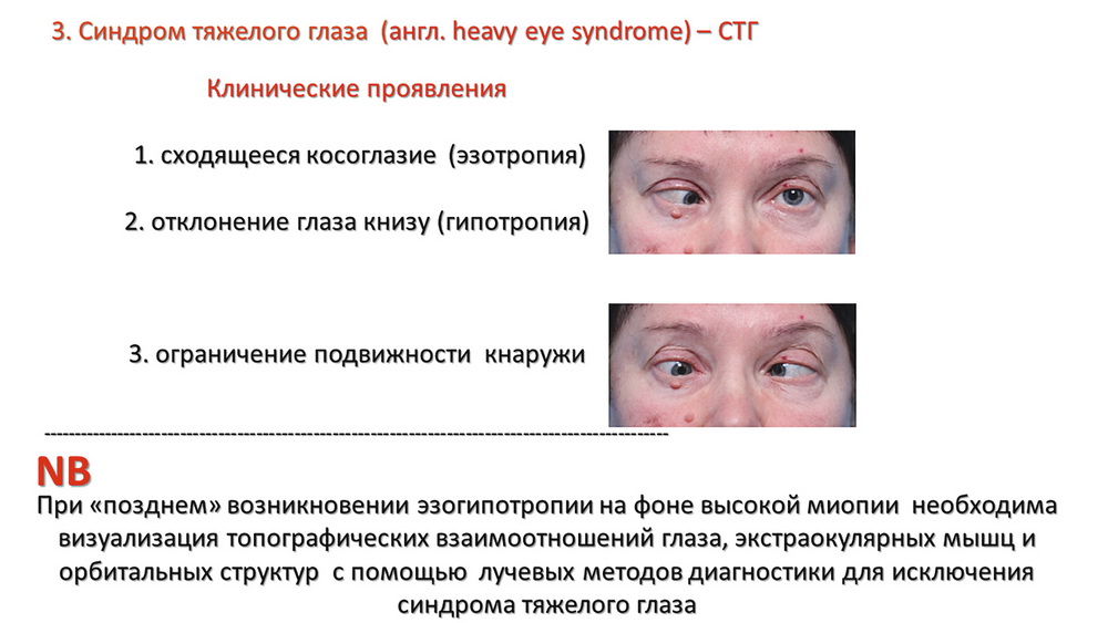 Синдром рейтинга