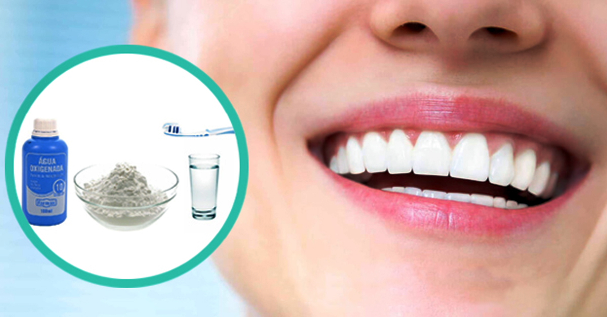 Перекись водорода полоскать рот зубы. Отбеливание зубов содой. Домашнее отбеливание зубов. Самостоятельное отбеливание зубов.