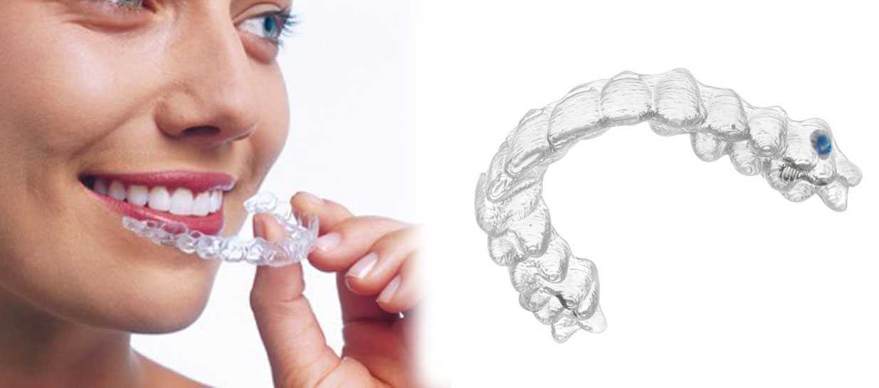 Капа на нижние зубы. Элайнеры Invisalign. Каппы элайнеры.