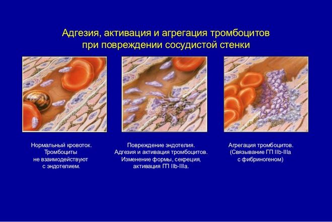 Адгезия в медицине. Адгезия и агрегация тромбоцитов. Агрегация (слипание) тромбоцитов. Адгезия тромбоцитов. Тромбоцитнери агрегация.