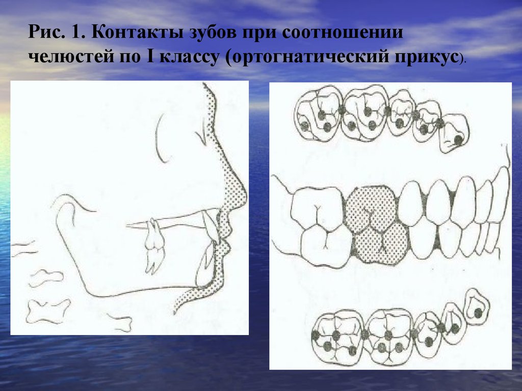 Контакты окклюзии. Правильное смыкание зубов сбоку. Центральная окклюзия ортогнатический прикус. Окклюзионные контакты зубов при 2 классе окклюзии. Ортогнатическом соотношении челюстей.