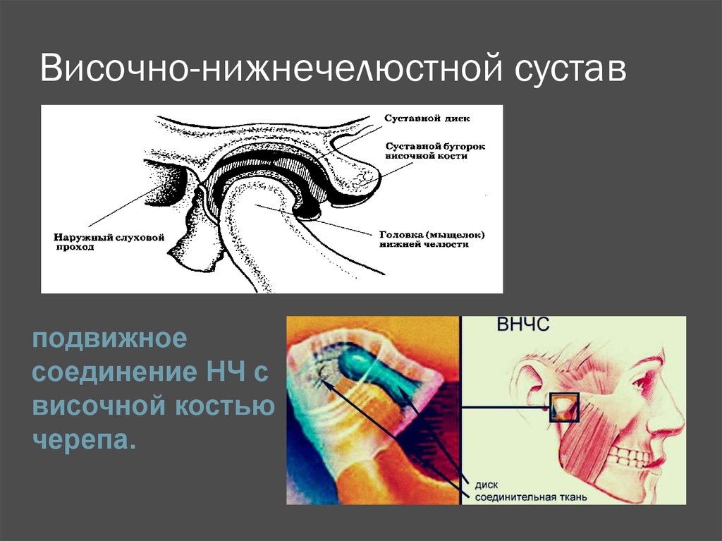 Внчс это. Строение ВНЧС схема. Анатомия ВНЧС схема. Схема височно-нижнечелюстного сустава. Височно-нижнечелюстной сустав по форме суставных поверхностей.