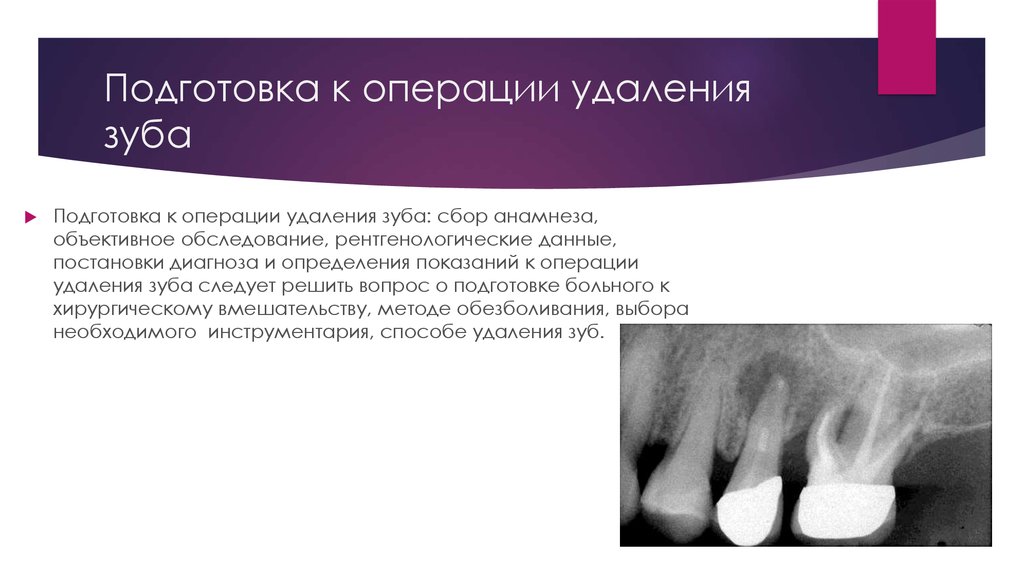 Удалить зуб последствие. Операция удаление зубов. Показания к операции удаления зуба. Подготовка пациента к операции удаления зуба.