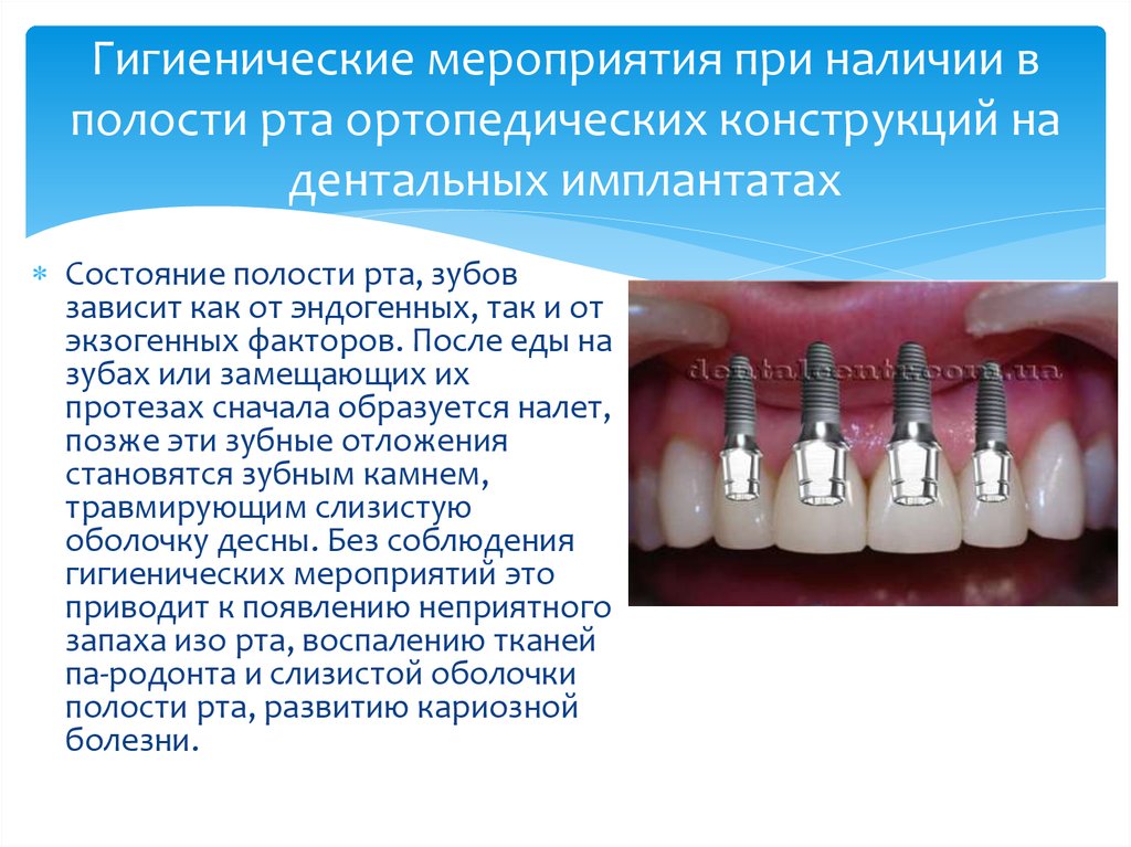 При наличии после. Гигиена полости рта при наличии ортопедических конструкций. Осложнения при дентальной имплантации. Гигиена полости рта при стоматологической имплантации. Памятка после профессиональной гигиены.