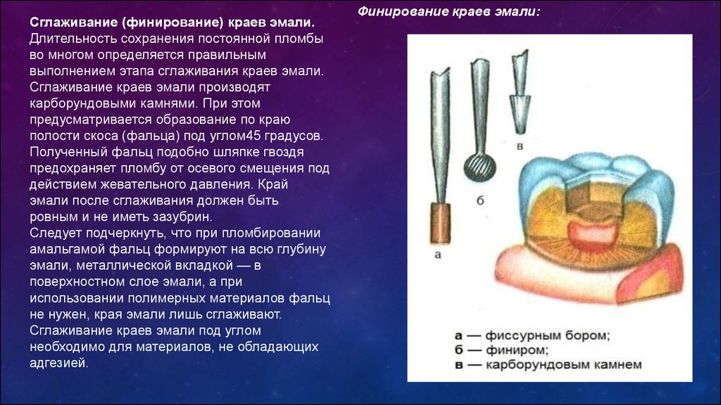 Пломбирование кариозных полостей v класса