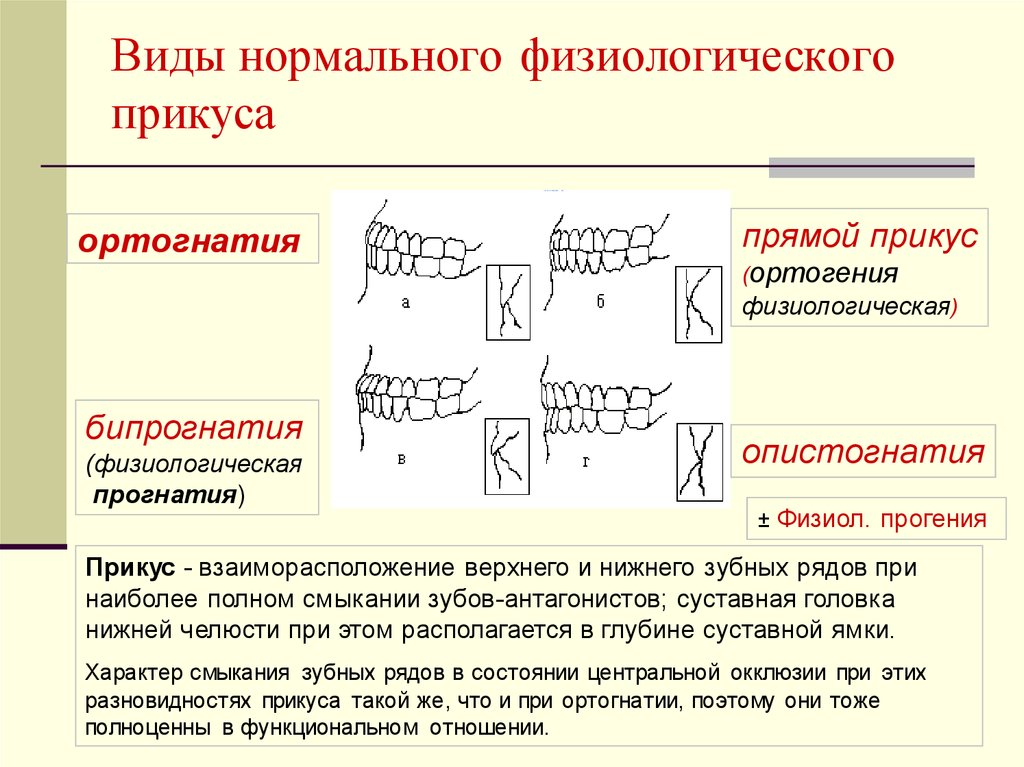 Виды прикуса