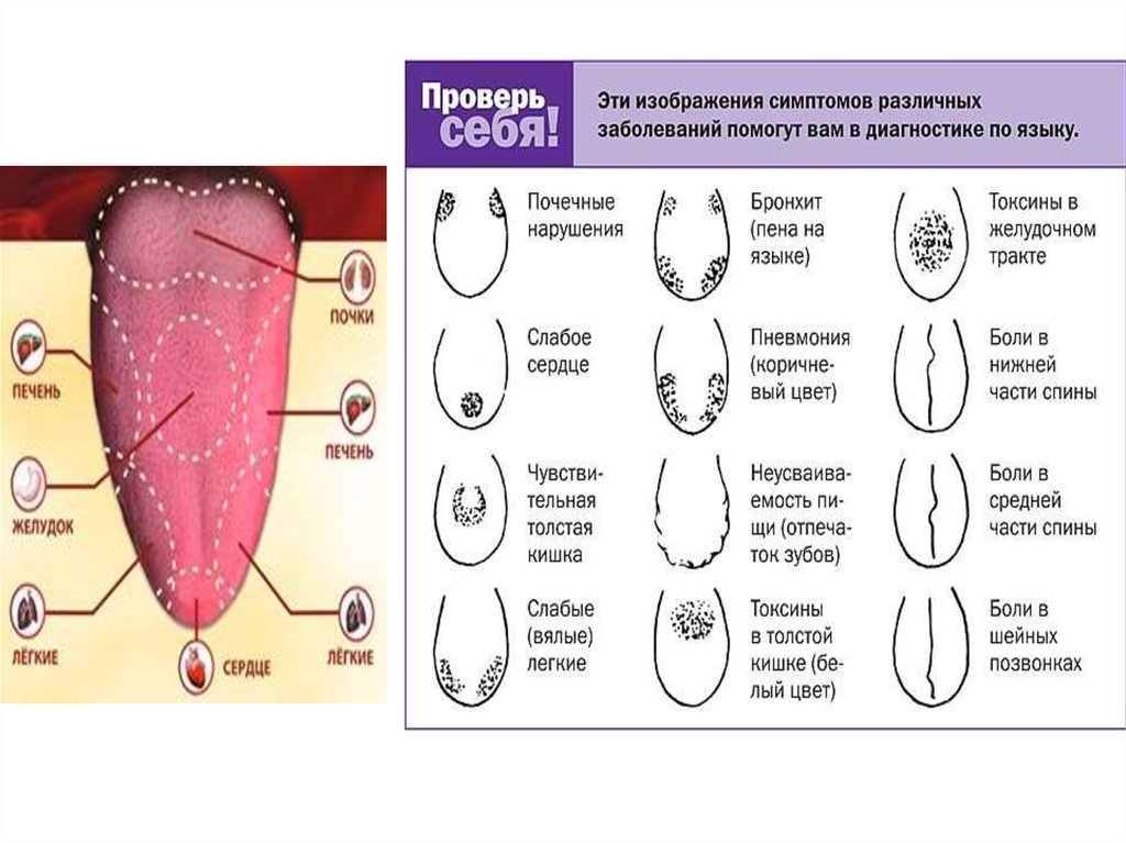 Язык признак какой болезни. Заболевания по цвету языка. Цвет языка при разных болезнях. Диагностика болезней по языку.