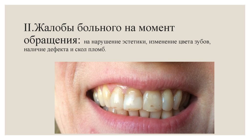 В момент обращения. Пломбирование дефектов зубов. Жалобы при патологической стираемости. Эстетическая стоматология презентация. Нарушение эстетики зубов.