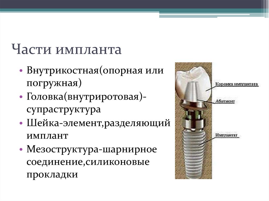 Имплант строение схема