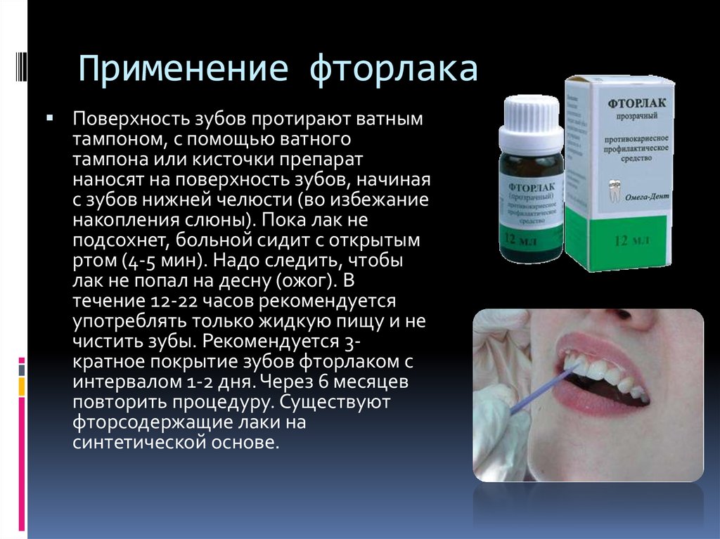 Препараты фтора являются эффективными средствами профилактики. Белагель фторлак. Фторлак в стоматологии. Методика покрытия зубов фторлаком. Фторсодержащие лаки для зубов.