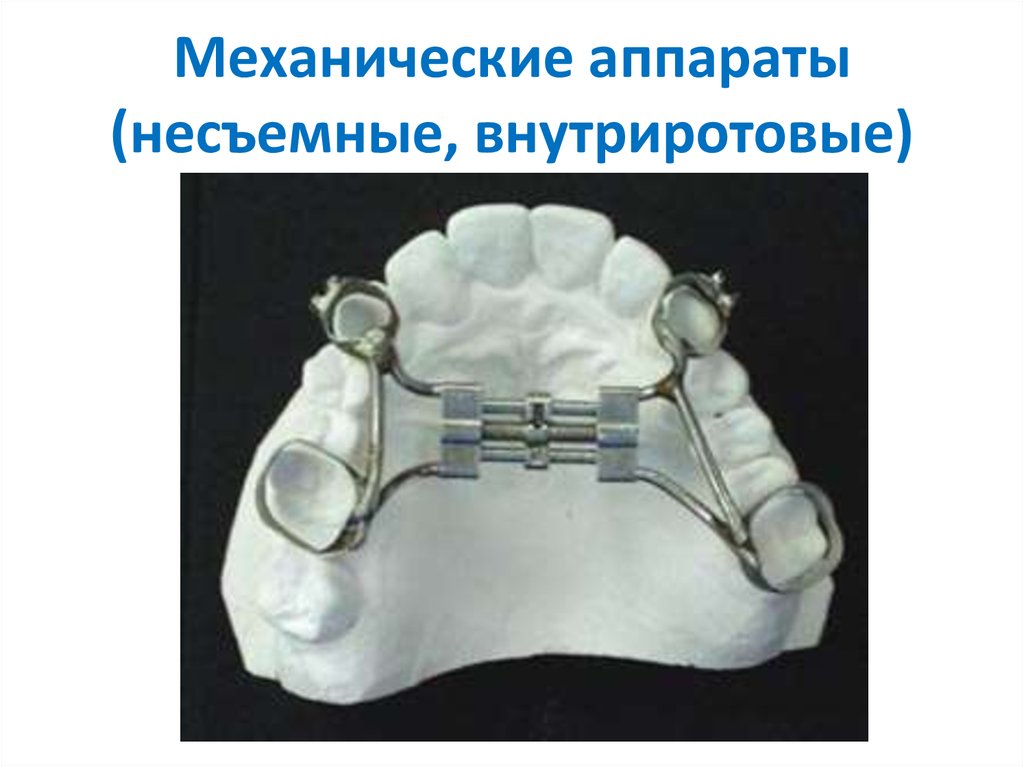 Ортодонтические аппараты механического действия презентация