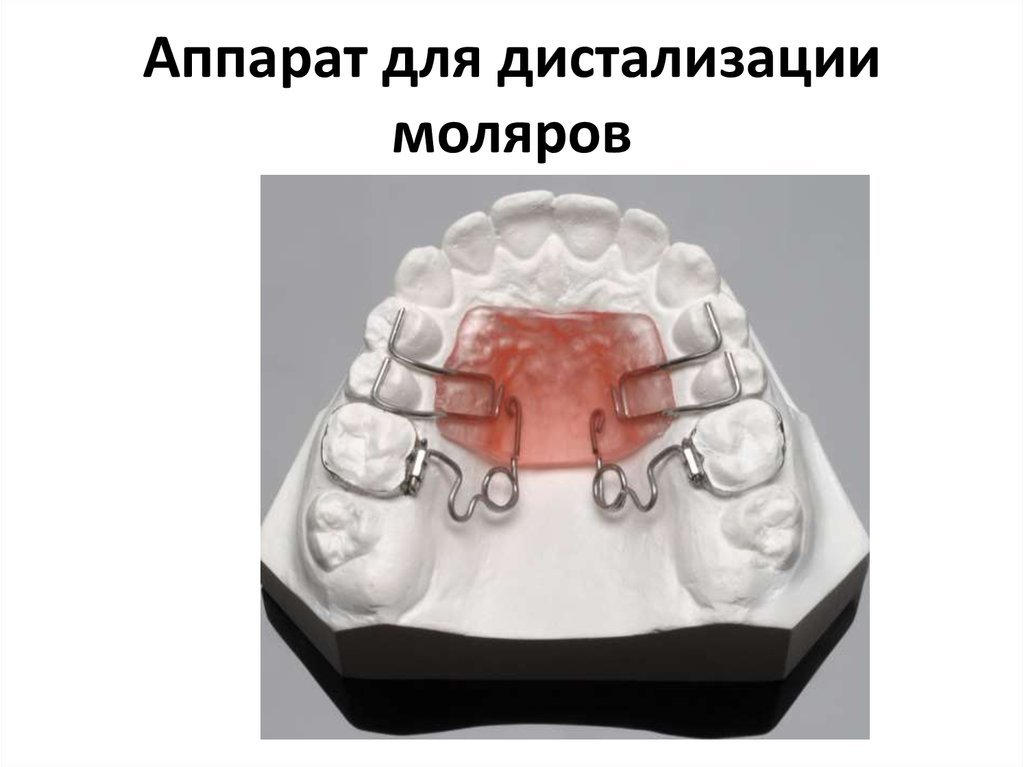 Ортодонтические аппараты механического действия презентация