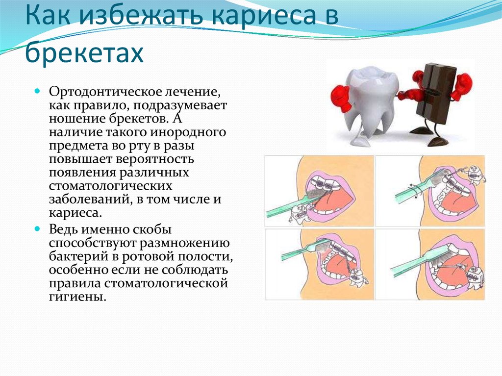 Профилактика кариеса. Памятка как избежать кариеса. Как предотвратить разрушения зубов.