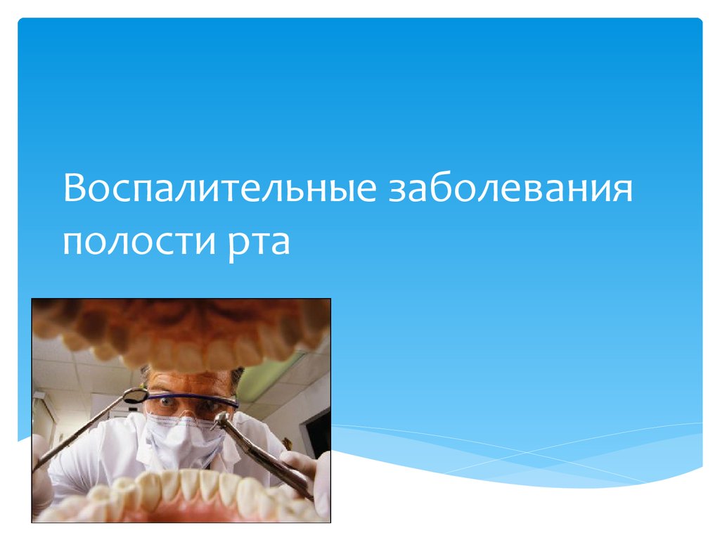 Инфекции полостей. Воспалительные заболевания ротовой полости. Одонтогенные инфекции. Невоспалительные заболевания полости рта. Одонтогенные заболевания полости рта.