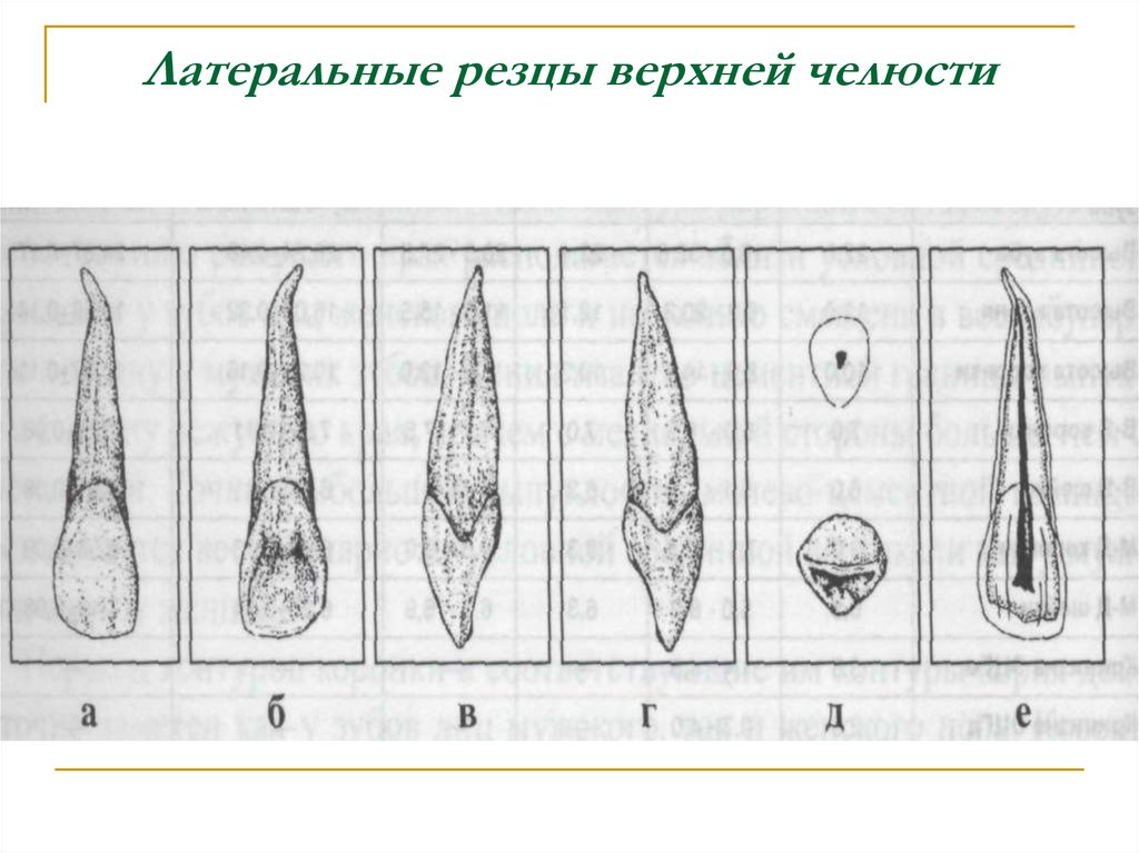 Центральных резцов. Латеральный резец верхней челюсти. Латеральный резец верхней челюсти анатомия. Мезиальный резец верхней челюсти. Медиальный резец верхней челюсти.