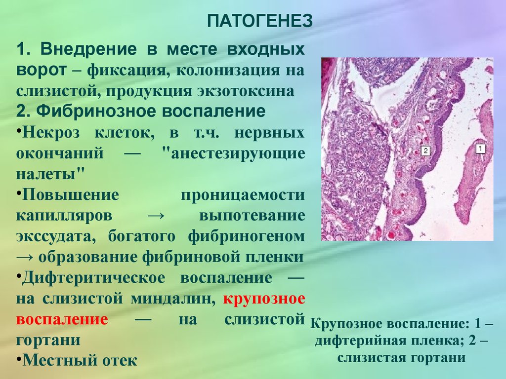 Крупозный трахеит микропрепарат рисунок