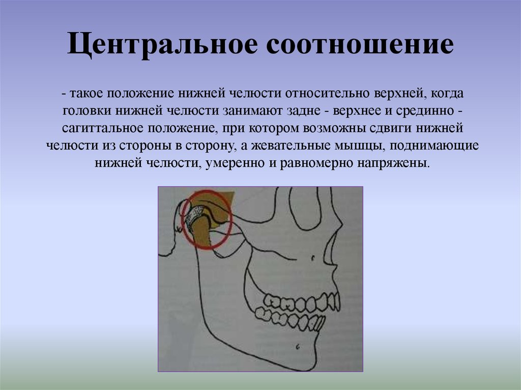 Прикус и окклюзионные контакты зубов презентация