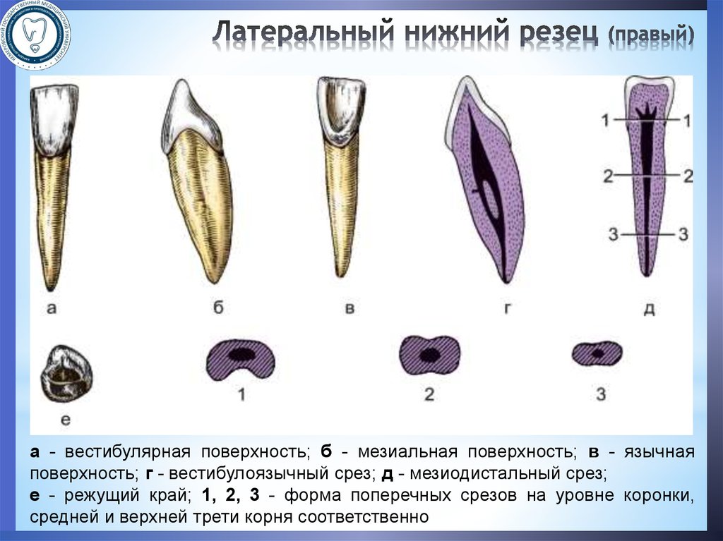 Режущий край. Нижний латеральный резец. Мезиодистальное направление зуба это. Вестибулярная поверхность резца. Латеральная поверхность резца.