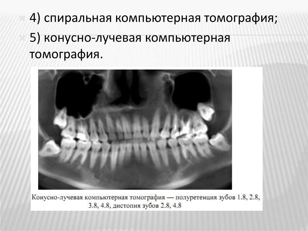 Можно 2 раза делать кт