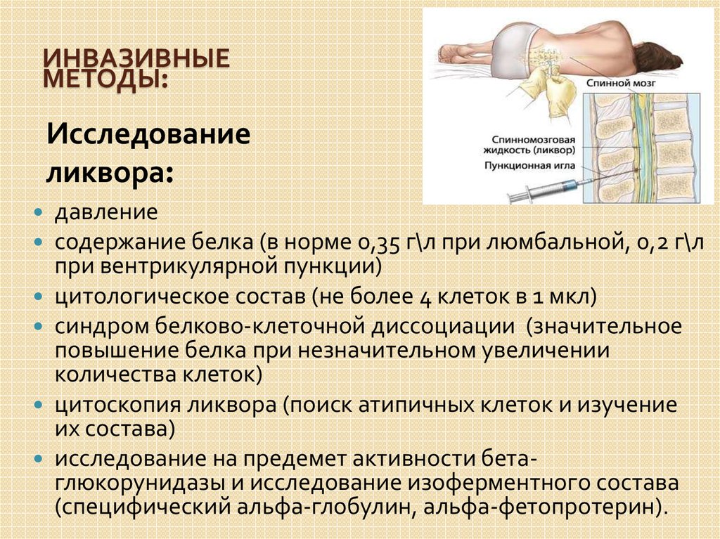 Ликвор спинномозговая пункция. Люмбальная пункция метод.