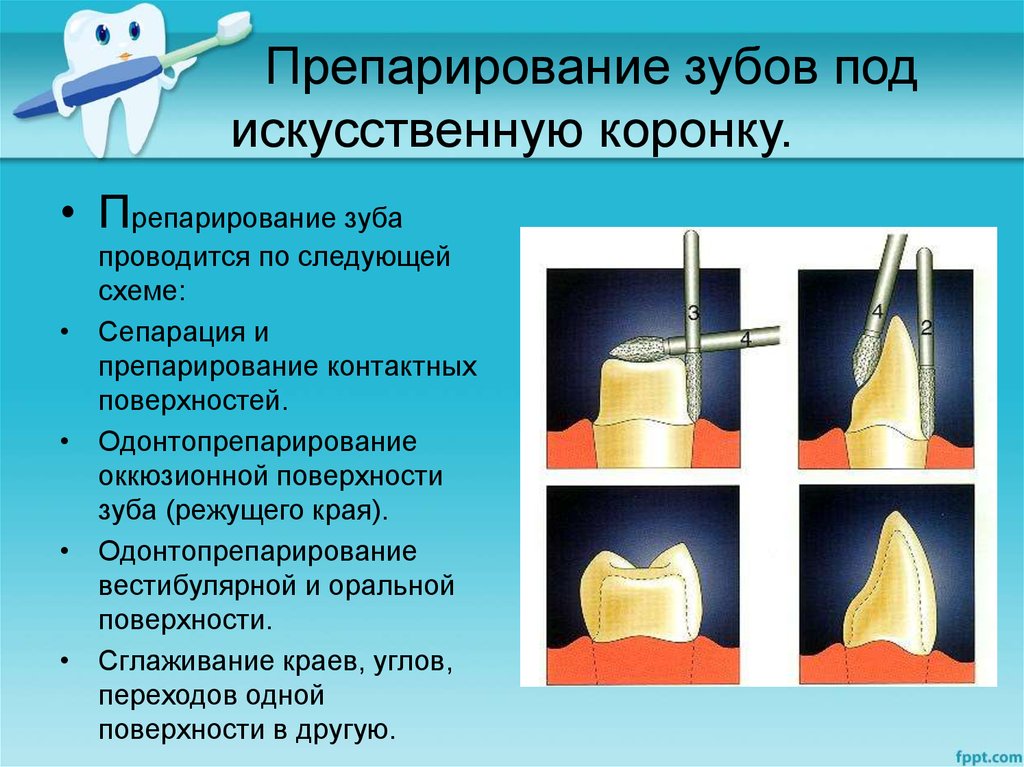 Штифтовые конструкции в ортопедической стоматологии презентация