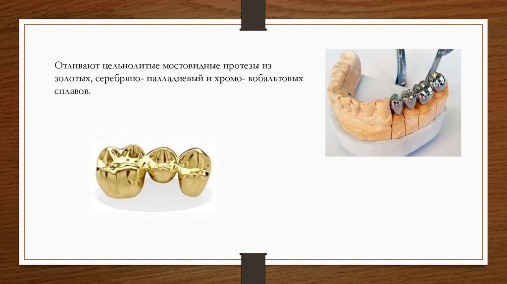 Цельнолитой мостовидный протез этапы изготовления. Цельнолитые мостовидные протезы. Цельнолитой мостовидный протез. Мостовидный протез из золота. Цельнолитые коронки лабораторные этапы.