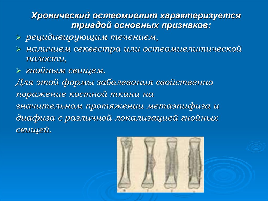 Хронический остеомиелит. Остеомиелит клинические проявления. Клиническая картина хронический гематогенный остеомиелит. Симптомы гематогенного остеомиелита. Остеомиелит фаза секвестрации.