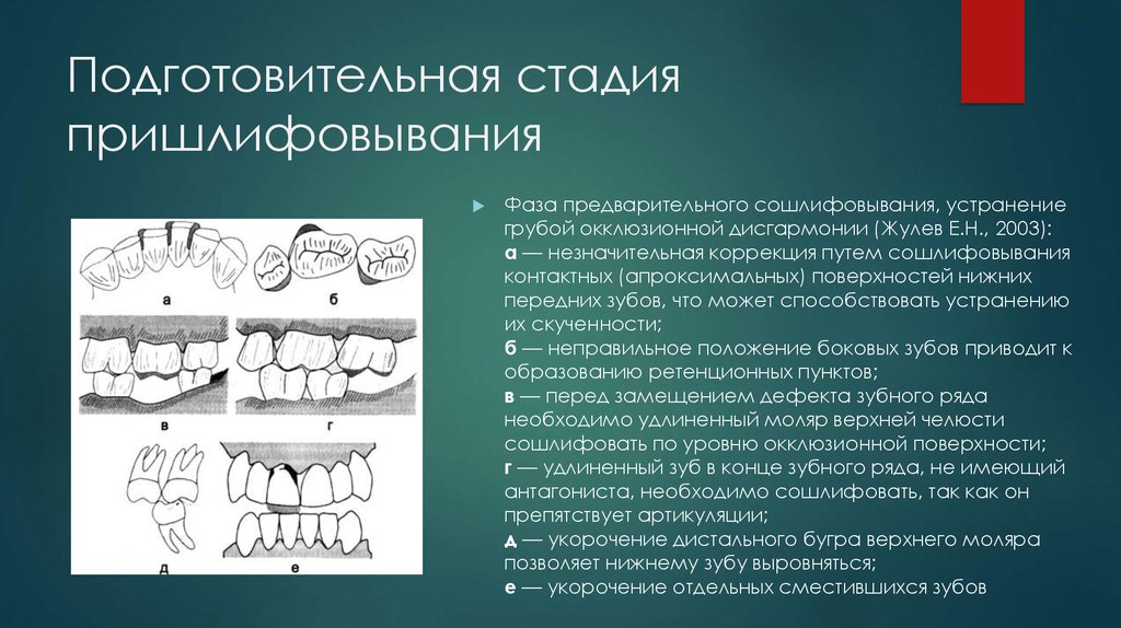 Метод окклюзии. Избирательная пришлифовка зубов методика. Избирательное пришлифовывание зуба. Этапы избирательного пришлифовывания зубов. Функциональное избирательное пришлифовывание зубов.