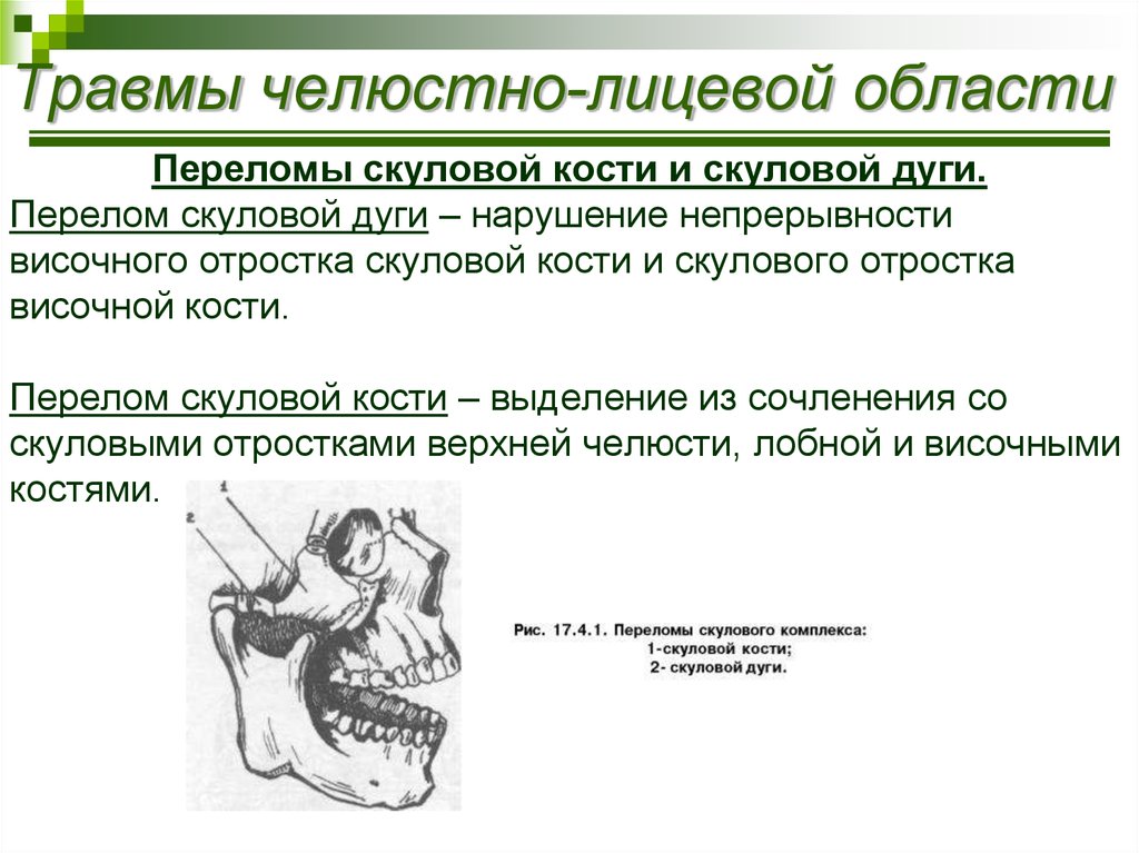 Переломы челюстей стоматология презентация