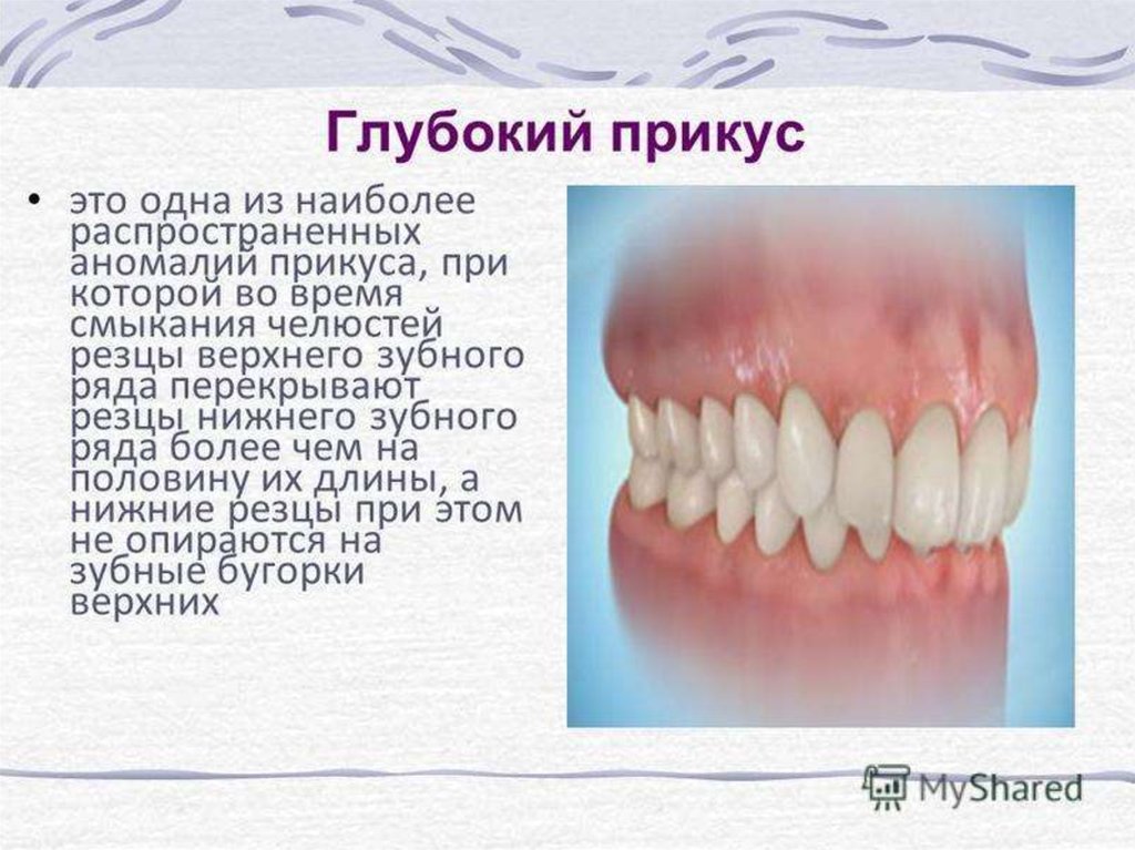 Какие должны быть зубы. Глубокий прикус и нормальный.