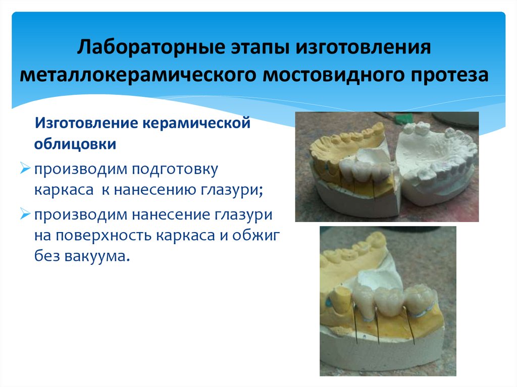 Пластмассовые коронки презентация