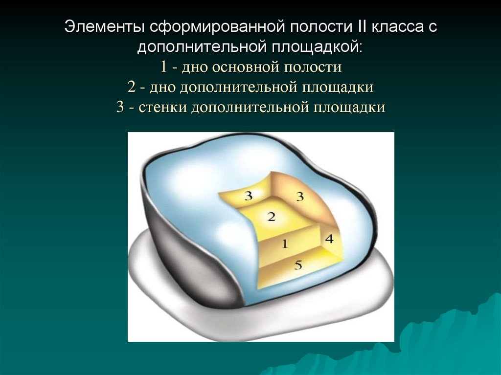 2 полости. Кариозные полости 2 класса по Блэку. Элементы сформированной кариозной полости 2 класса. Элементы сформированной полости. Элементы отпрепарированной кариозной полости.