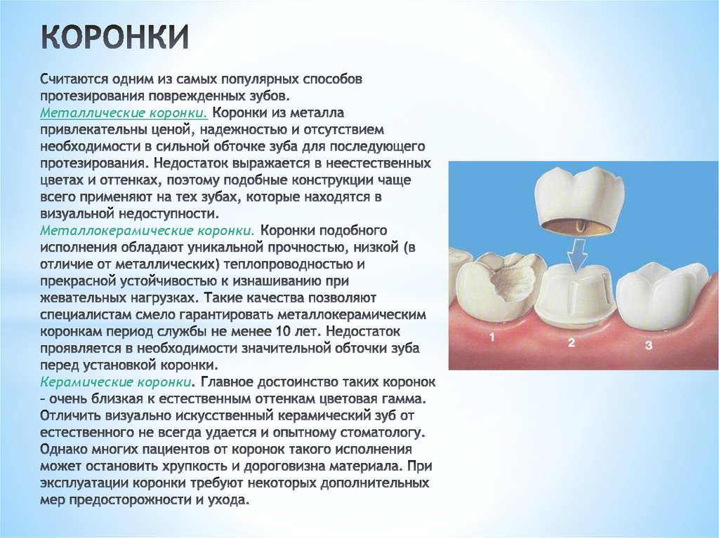 Виды коронок презентация