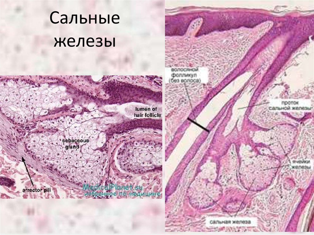 Нормальное строение. Строение сальной железы гистология. Потовая железа гистология препарат. Сальная железа препарат гистология. Потовые железы кожи гистология.