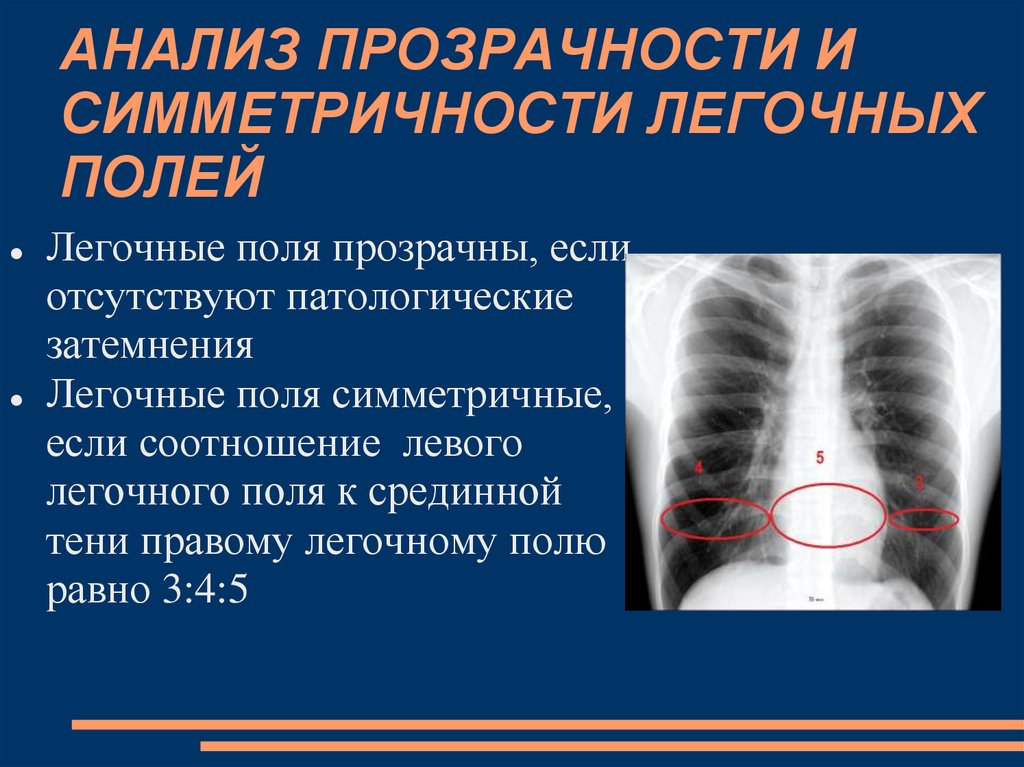 Поле легкого. Прозрачность легочных полей. Прозрачность легочных полей повышена. Легочные поля симметричны. Легочные поля прозрачные.