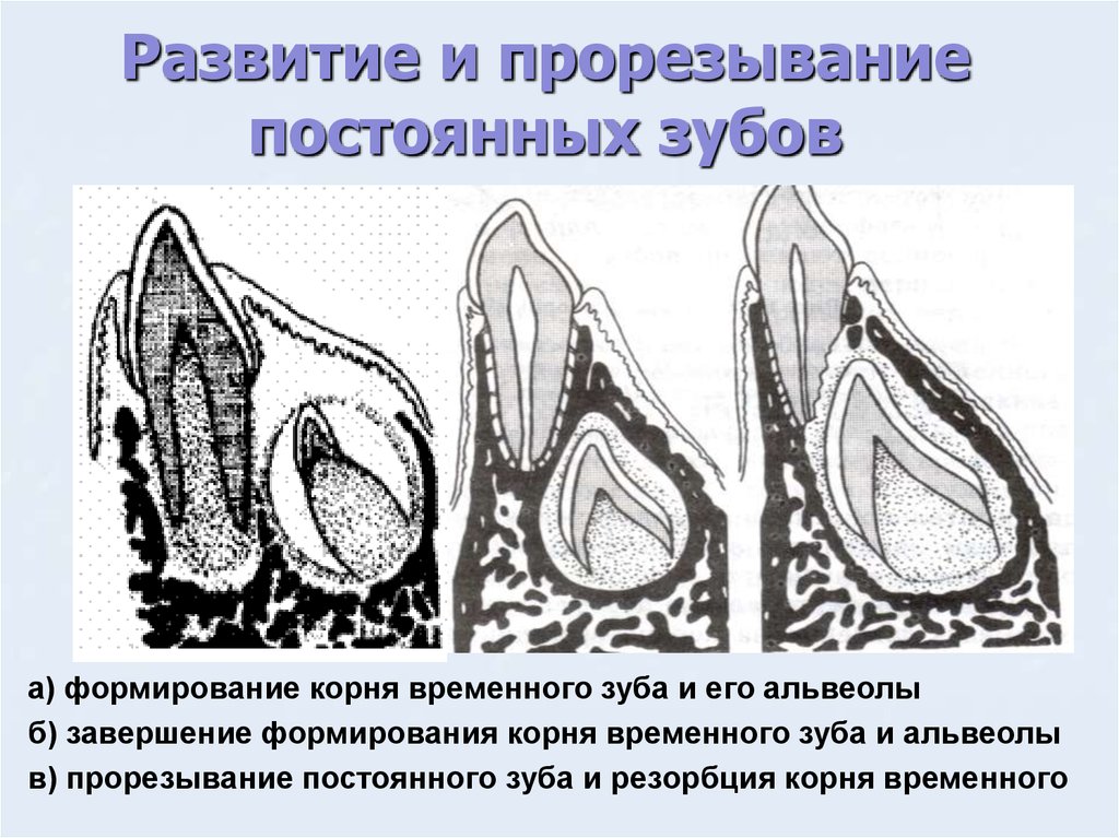 Зачатки это. Развитие постоянных зубов. Формирование зачатков постоянных зубов. Стадии развития постоянного зуба. Формирование постоянного зуба гистология.