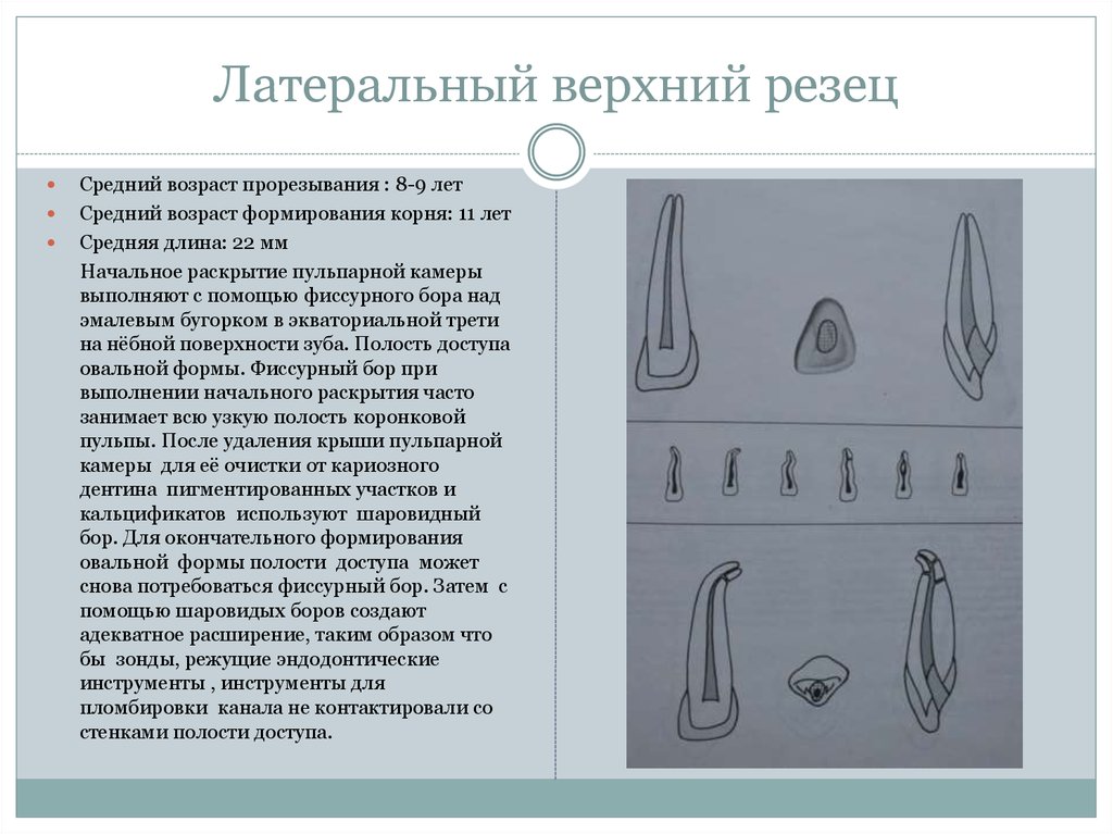 Верхних резцов. Центральный резец нижней челюсти полость зуба. Морфология латерального резца верхней челюсти. Центральный резец верхней челюсти топография каналов. Эндодоступ латеральный резец нижней челюсти.