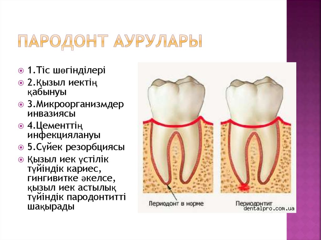 Периодонт