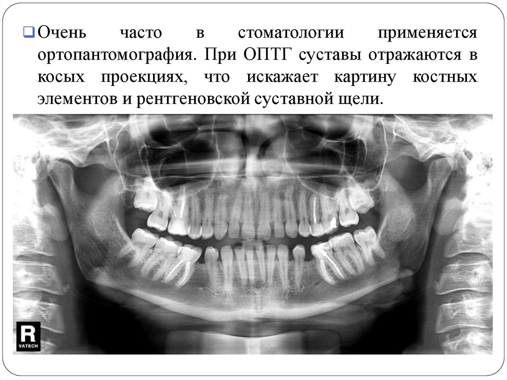 Направление на оптг образец