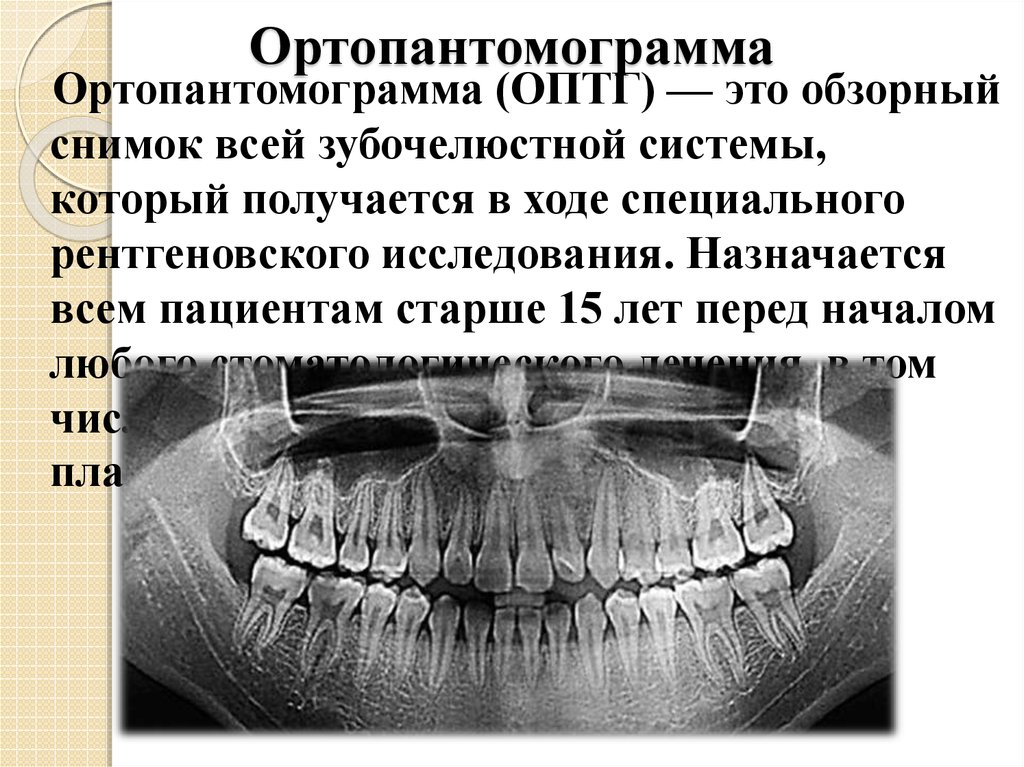 Описание рентген снимка зуба образец