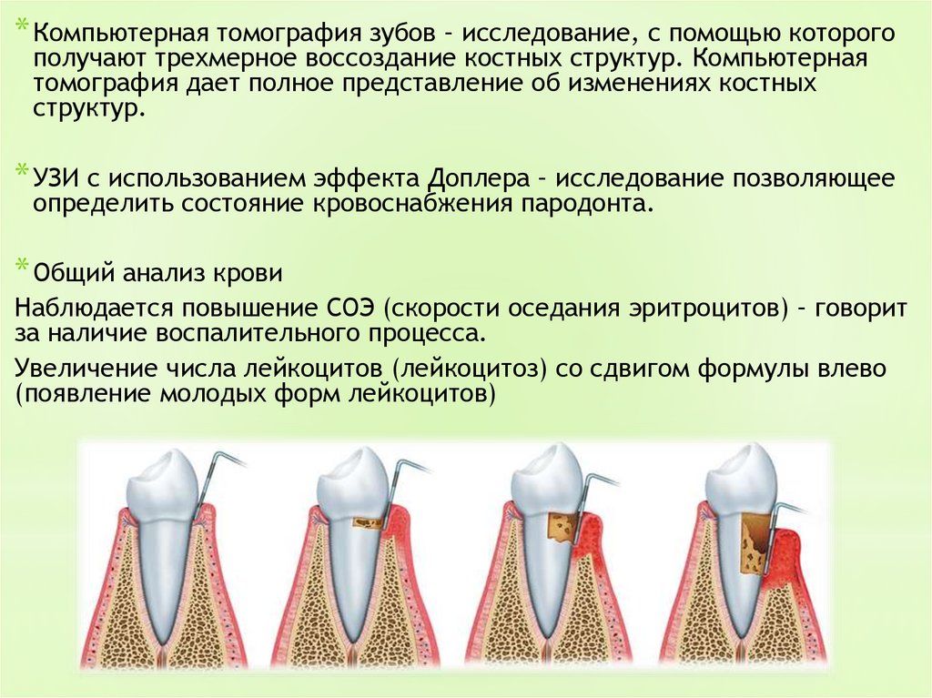 Состояние тканей пародонта