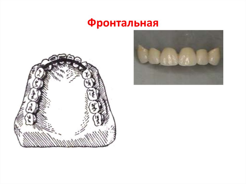 Виды шинирования в ортопедической стоматологии презентация