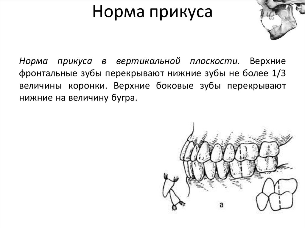 Правильное смыкание зубов схема