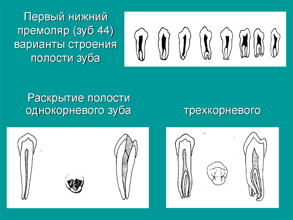 Премоляры и моляры предназначены для у млекопитающих. Первый премоляр нижней челюсти анатомия. Первый Нижний премоляр строение. Премоляры зубы анатомия.