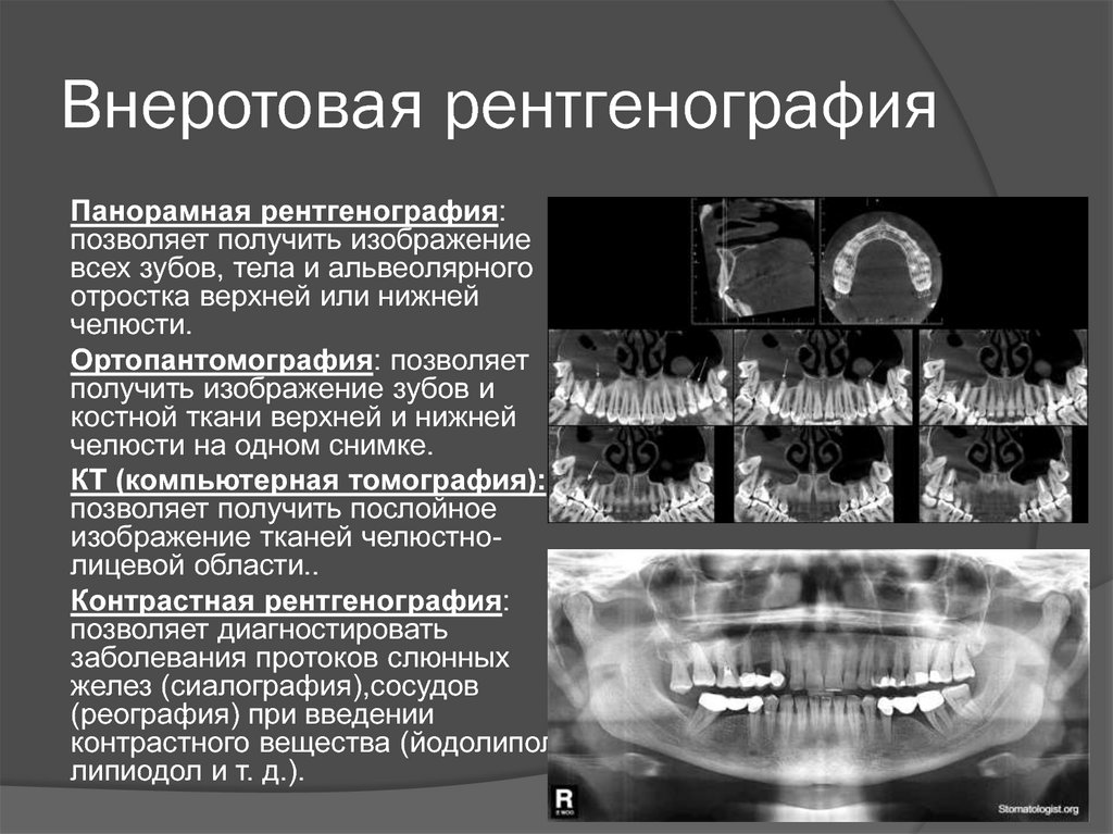 К трехмерным реконструкциям кт изображений относят